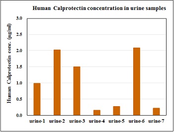 Human calprotectin concentration in urine samples from healthy volunteers